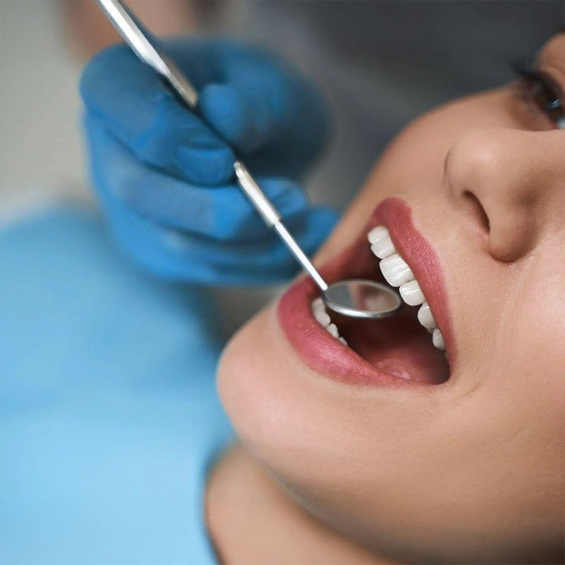 Check up prima visita dentistica