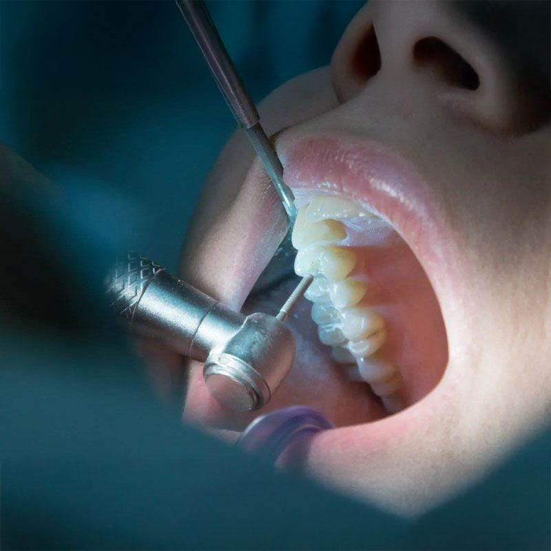 Endodonzia